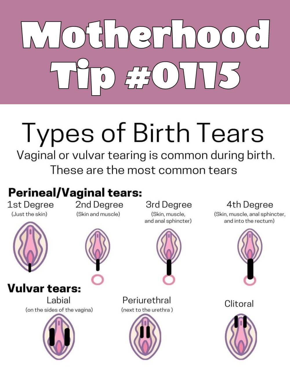 Parenting and Pregnancy Infographic | Motherhood Tip #0115